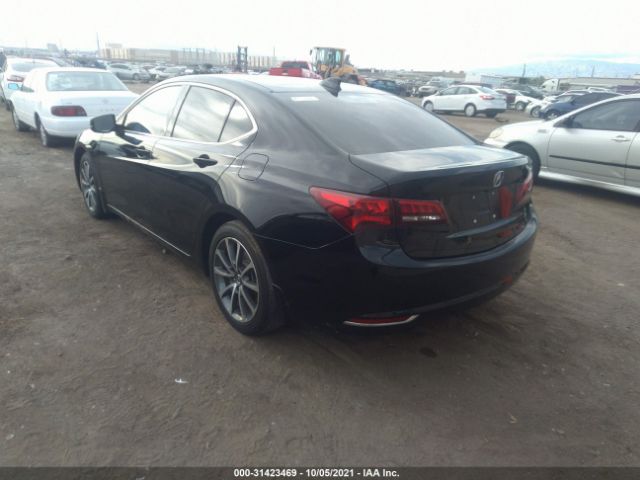 Photo 2 VIN: 19UUB2F31HA004865 - ACURA TLX 