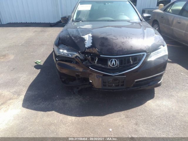 Photo 5 VIN: 19UUB2F33FA009739 - ACURA TLX 