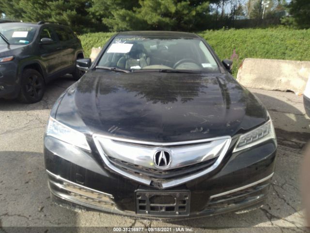 Photo 5 VIN: 19UUB2F34GA004860 - ACURA TLX 