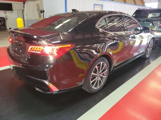 Photo 3 VIN: 19UUB2F34JA006132 - ACURA TLX 