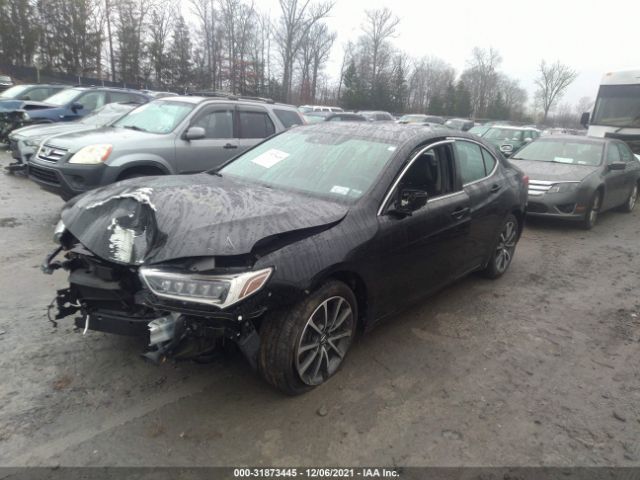 Photo 1 VIN: 19UUB2F34JA006311 - ACURA TLX 