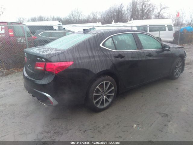 Photo 3 VIN: 19UUB2F34JA006311 - ACURA TLX 