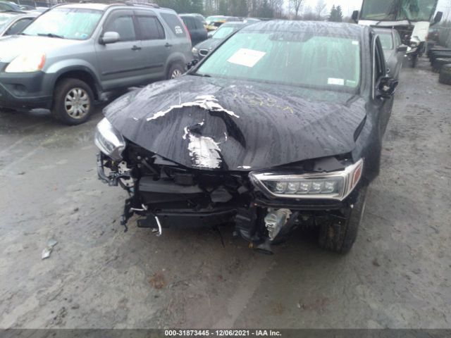 Photo 5 VIN: 19UUB2F34JA006311 - ACURA TLX 