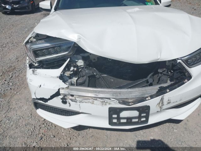 Photo 5 VIN: 19UUB2F34KA006102 - ACURA TLX 