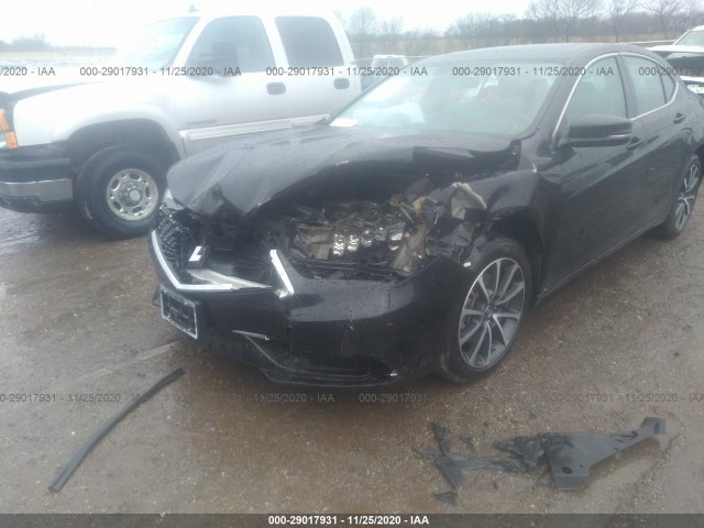 Photo 5 VIN: 19UUB2F36LA001386 - ACURA TLX 