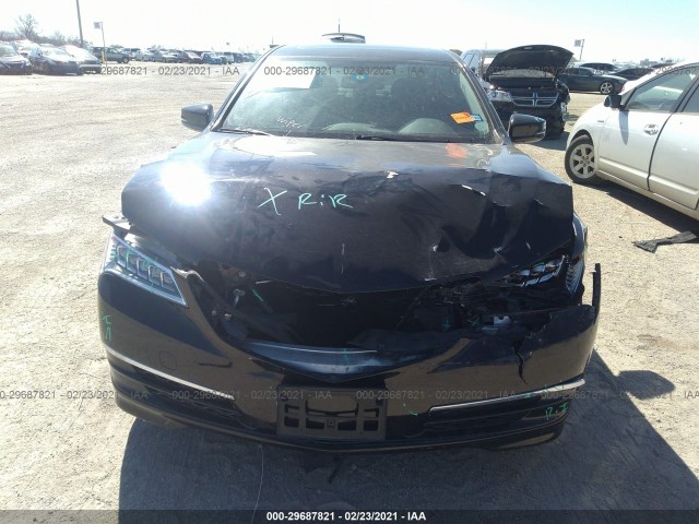 Photo 5 VIN: 19UUB2F38FA006416 - ACURA TLX 