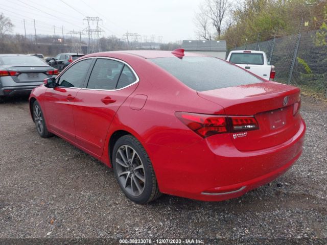 Photo 2 VIN: 19UUB2F38HA007021 - ACURA TLX 