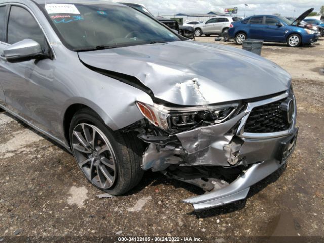 Photo 5 VIN: 19UUB2F38JA011642 - ACURA TLX 