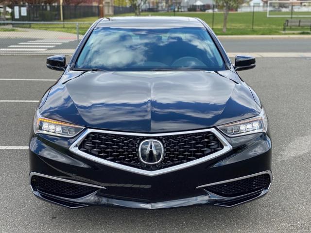 Photo 2 VIN: 19UUB2F38KA005308 - ACURA TLX 