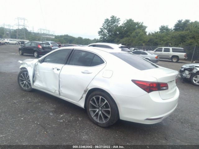 Photo 2 VIN: 19UUB2F39FA014315 - ACURA TLX 