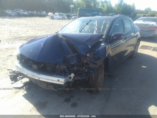 Photo 1 VIN: 19UUB2F39KA009335 - ACURA TLX 