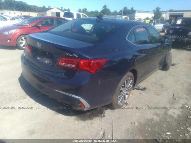 Photo 3 VIN: 19UUB2F39KA009335 - ACURA TLX 