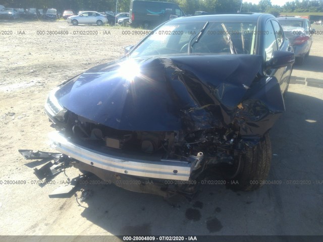 Photo 5 VIN: 19UUB2F39KA009335 - ACURA TLX 