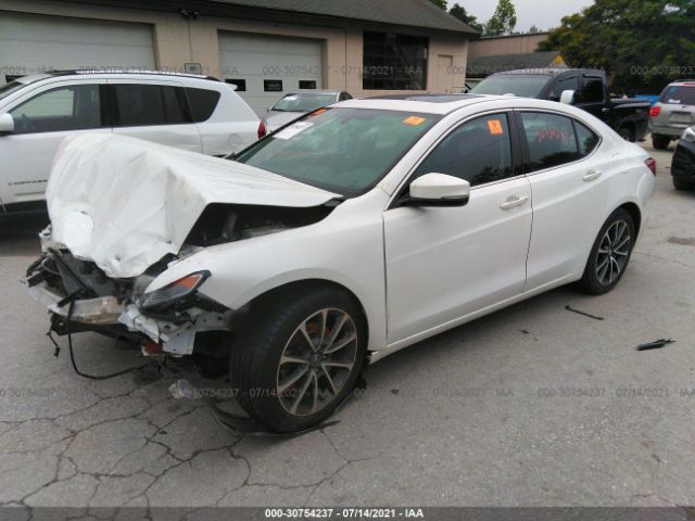 Photo 1 VIN: 19UUB2F3XHA006274 - ACURA TLX 