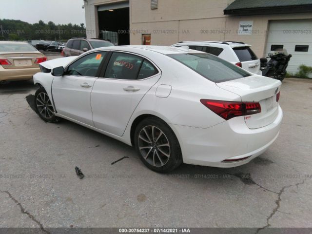 Photo 2 VIN: 19UUB2F3XHA006274 - ACURA TLX 