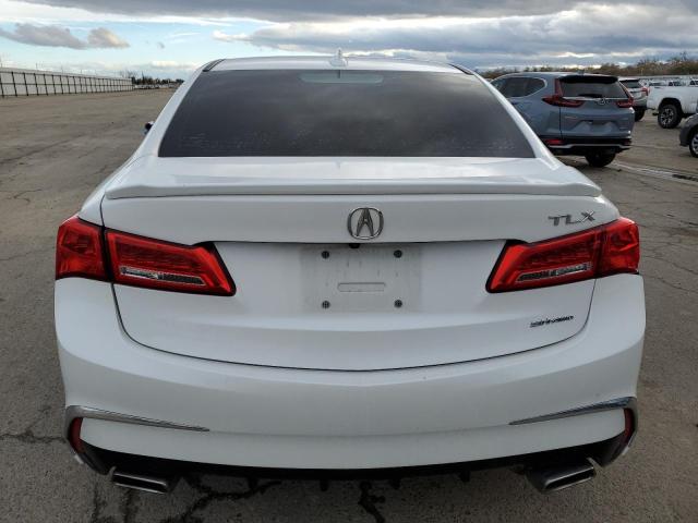 Photo 5 VIN: 19UUB2F3XJA006491 - ACURA TLX 