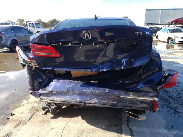 Photo 5 VIN: 19UUB2F44LA004019 - ACURA TLX TECHNO 