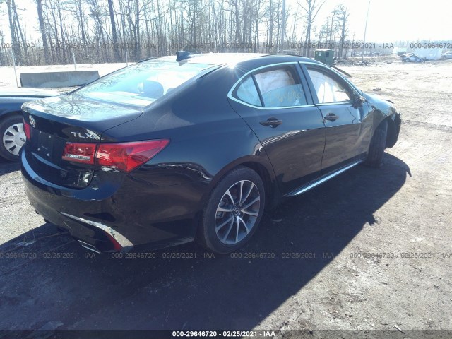 Photo 3 VIN: 19UUB2F50JA008364 - ACURA TLX 