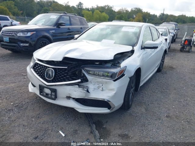 Photo 5 VIN: 19UUB2F50JA010731 - ACURA TLX 