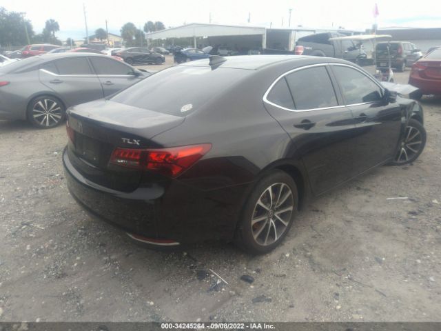 Photo 3 VIN: 19UUB2F51FA000829 - ACURA TLX 