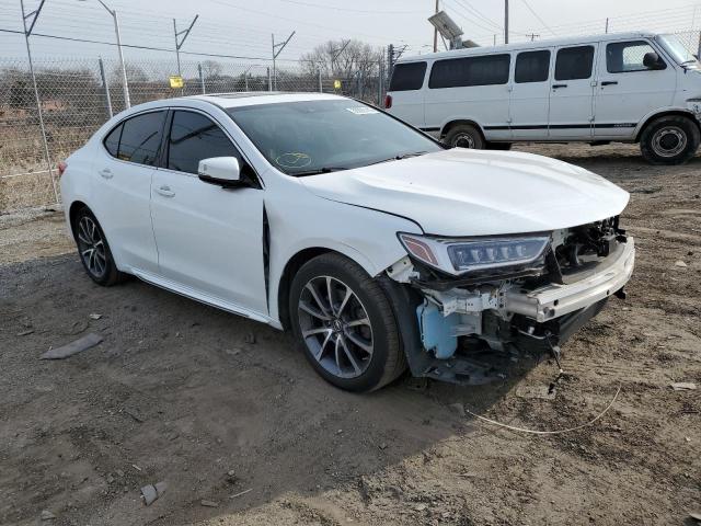 Photo 3 VIN: 19UUB2F51JA009247 - ACURA TLX TECH 