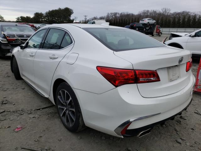 Photo 2 VIN: 19UUB2F51JA009250 - ACURA TLX TECH 