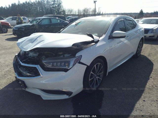 Photo 1 VIN: 19UUB2F52JA005451 - ACURA TLX 