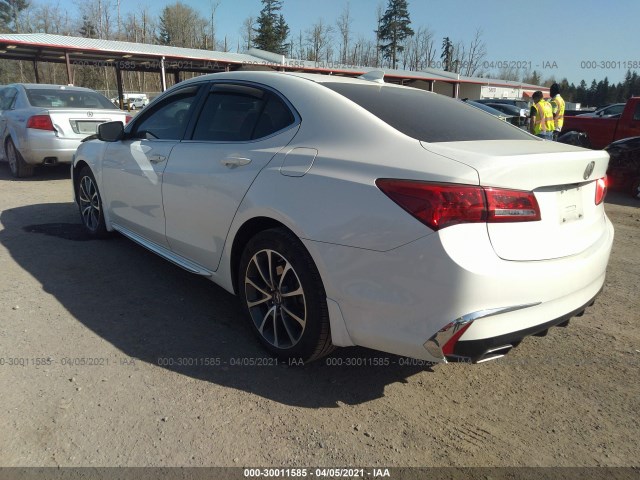 Photo 2 VIN: 19UUB2F52JA005451 - ACURA TLX 