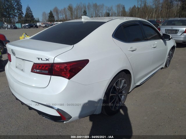 Photo 3 VIN: 19UUB2F52JA005451 - ACURA TLX 