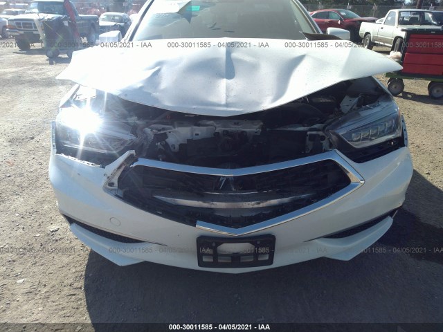 Photo 5 VIN: 19UUB2F52JA005451 - ACURA TLX 