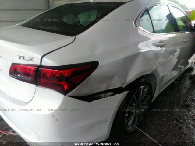 Photo 5 VIN: 19UUB2F55HA002618 - ACURA TLX 