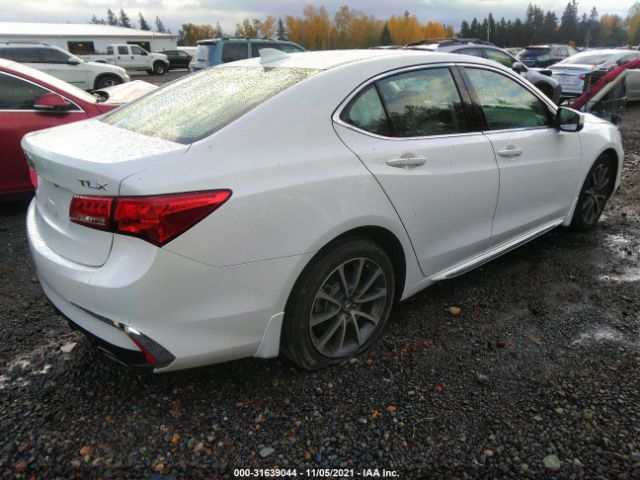 Photo 3 VIN: 19UUB2F55JA007257 - ACURA TLX 