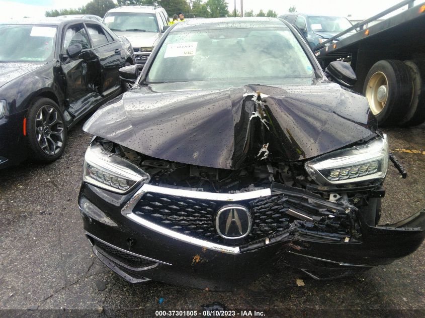 Photo 11 VIN: 19UUB2F56JA010667 - ACURA TLX 