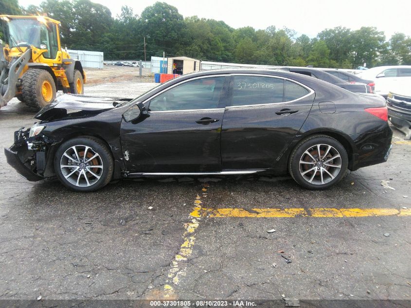 Photo 13 VIN: 19UUB2F56JA010667 - ACURA TLX 