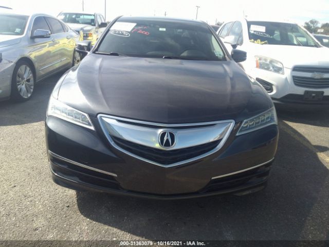 Photo 5 VIN: 19UUB2F57GA009813 - ACURA TLX 