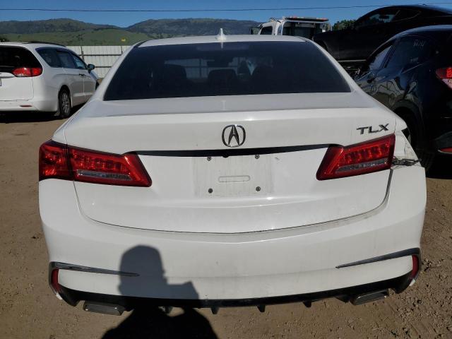 Photo 5 VIN: 19UUB2F57JA007423 - ACURA TLX 