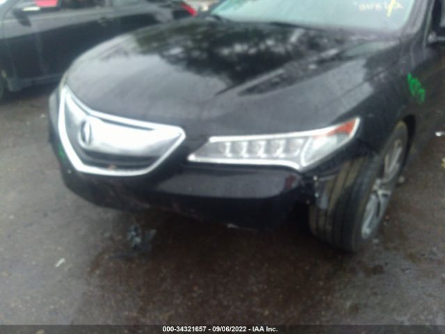 Photo 5 VIN: 19UUB2F58GA011862 - ACURA TLX 