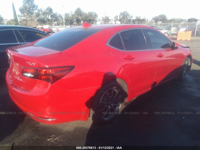 Photo 3 VIN: 19UUB2F58HA003102 - ACURA TLX 