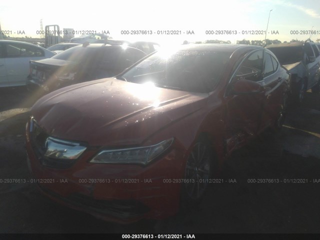 Photo 5 VIN: 19UUB2F58HA003102 - ACURA TLX 