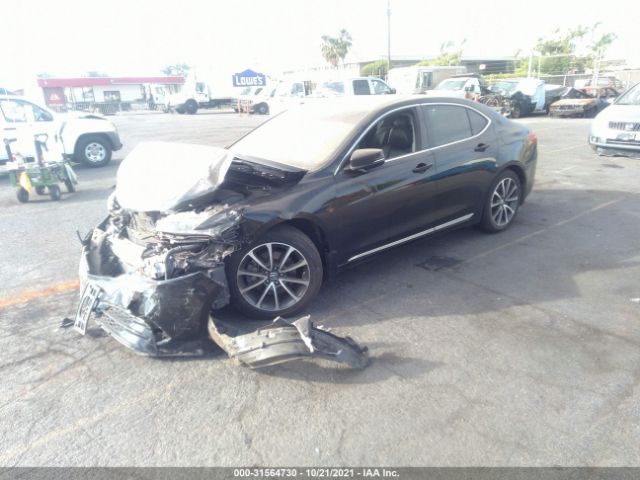 Photo 1 VIN: 19UUB2F5XFA013529 - ACURA TLX 