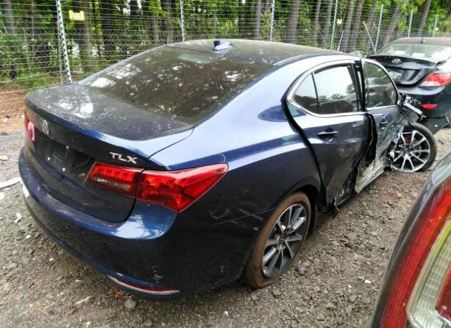 Photo 3 VIN: 19UUB2F5XHA004963 - ACURA TLX 