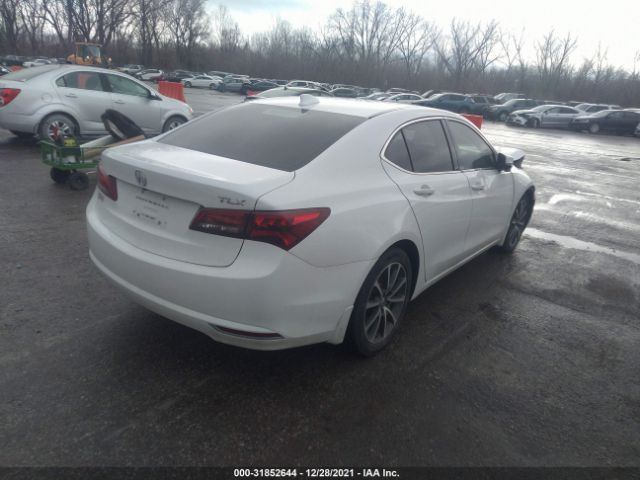 Photo 3 VIN: 19UUB2F5XHA006535 - ACURA TLX 