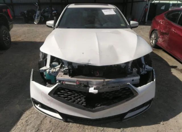 Photo 5 VIN: 19UUB2F60JA000662 - ACURA TLX 