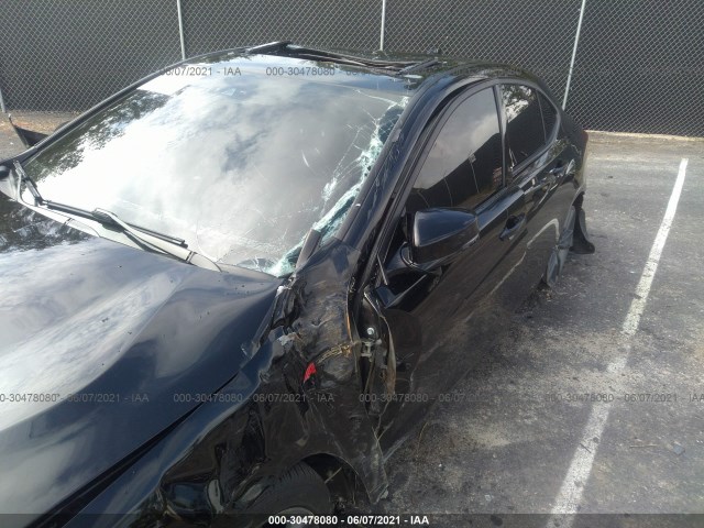 Photo 5 VIN: 19UUB2F61KA005547 - ACURA TLX 