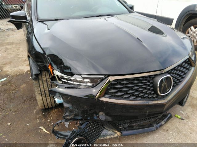 Photo 5 VIN: 19UUB2F62LA004148 - ACURA TLX 