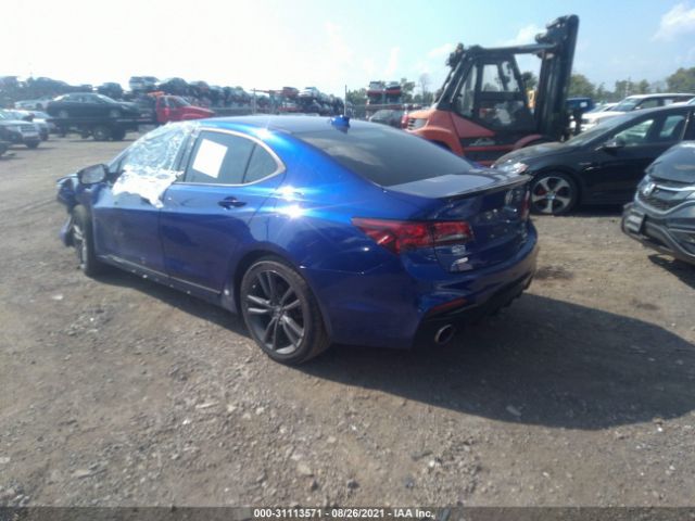 Photo 2 VIN: 19UUB2F63JA012594 - ACURA TLX 