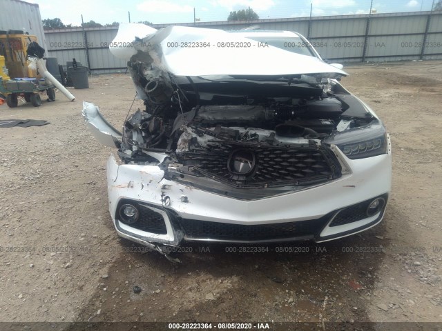 Photo 5 VIN: 19UUB2F64JA013334 - ACURA TLX 