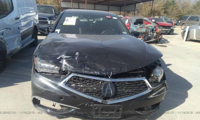 Photo 5 VIN: 19UUB2F65JA010006 - ACURA TLX 