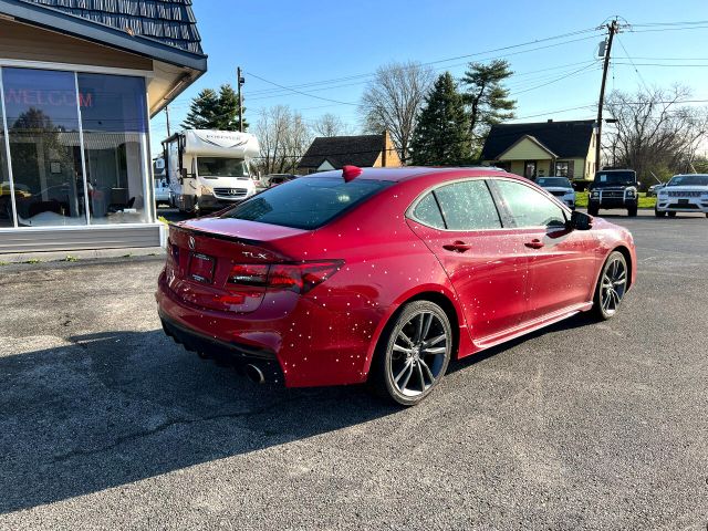 Photo 3 VIN: 19UUB2F67JA002702 - ACURA TLX 