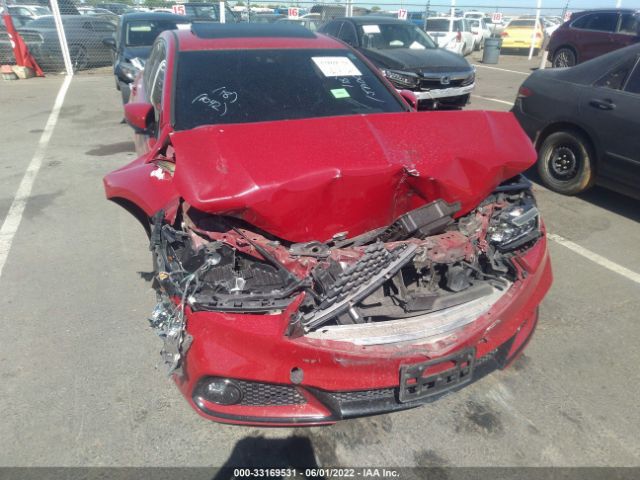 Photo 5 VIN: 19UUB2F68JA001042 - ACURA TLX 